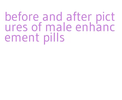 before and after pictures of male enhancement pills