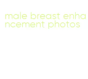 male breast enhancement photos